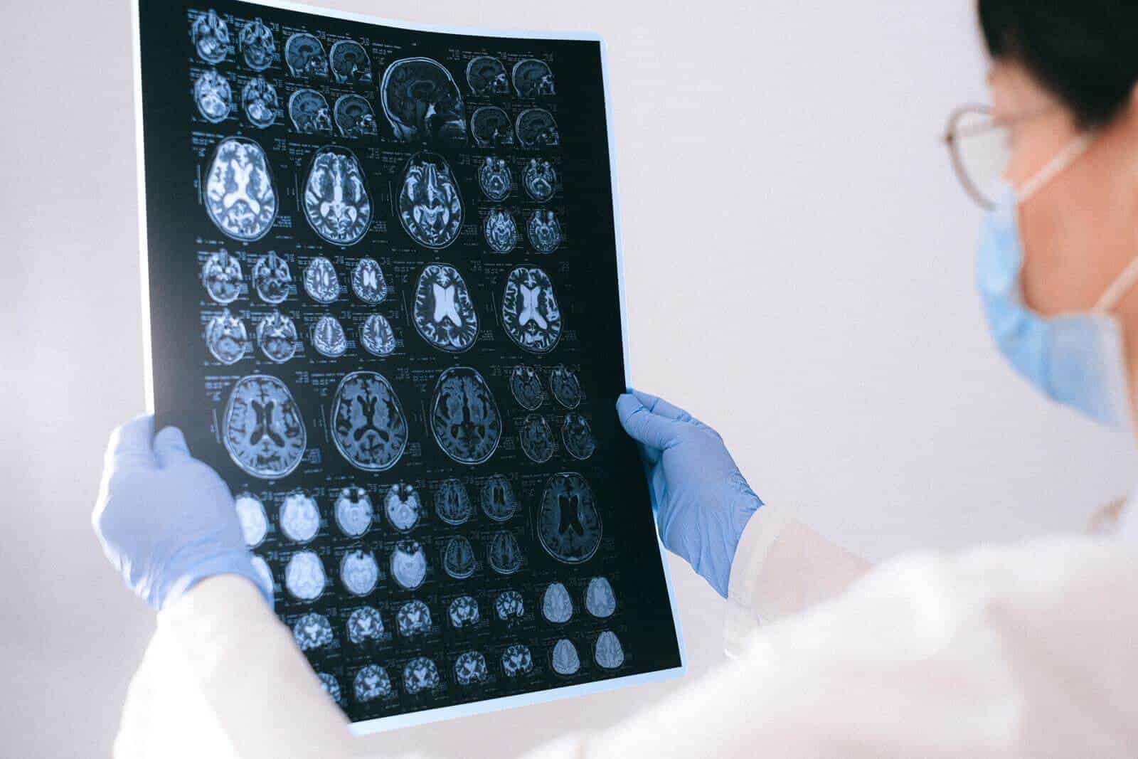 Expert Neurosurgery Billing Services for Brain, Spine & Peripheral Nerve Practices in the USA header image
