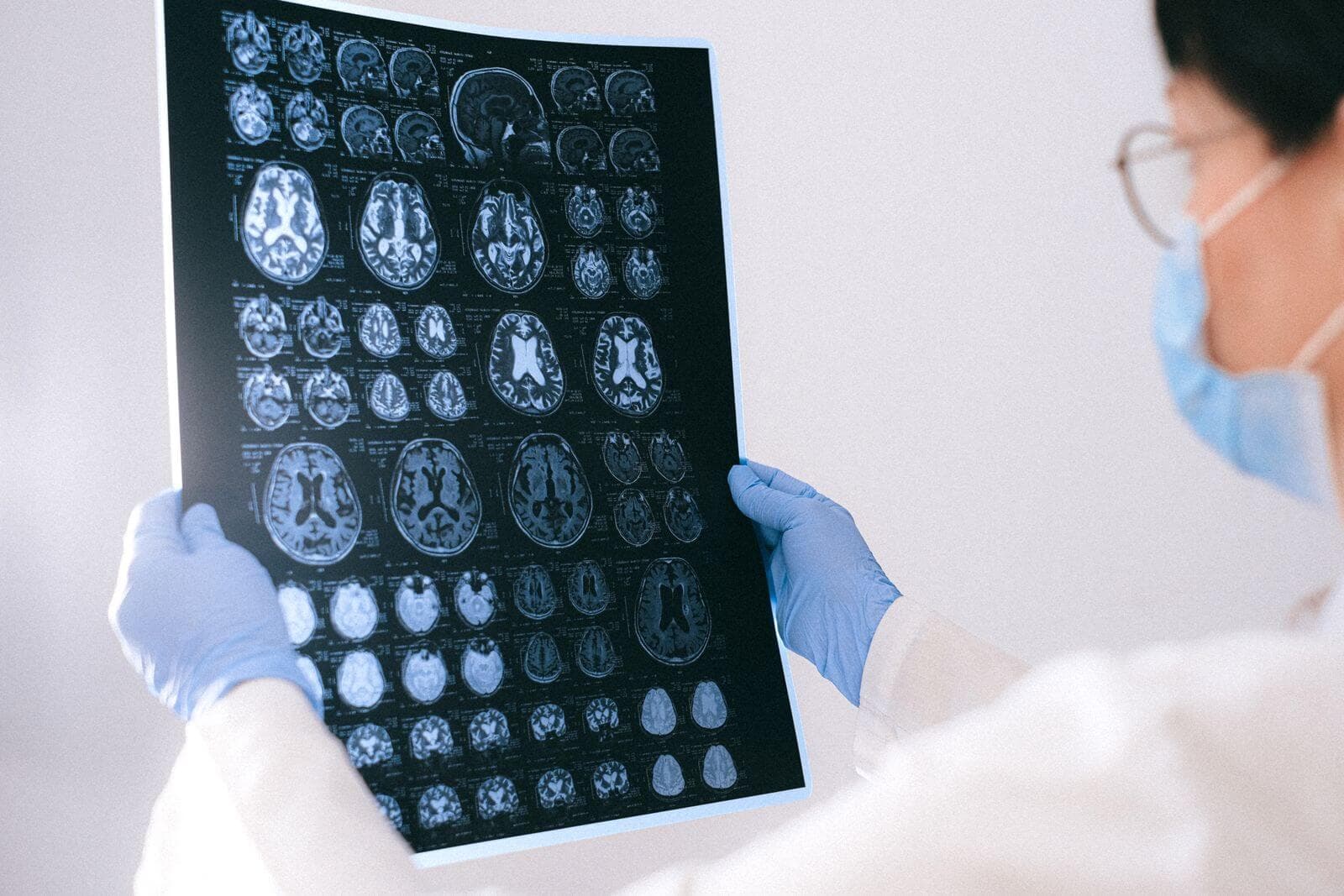 Expert Neurosurgery Billing Services for Brain, Spine & Peripheral Nerve Practices in the USA header image